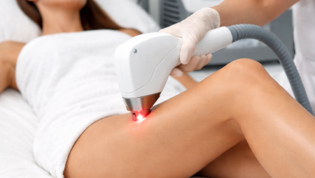 Lazer Epilasyon Nedir ve Neden Tercih Edilir?